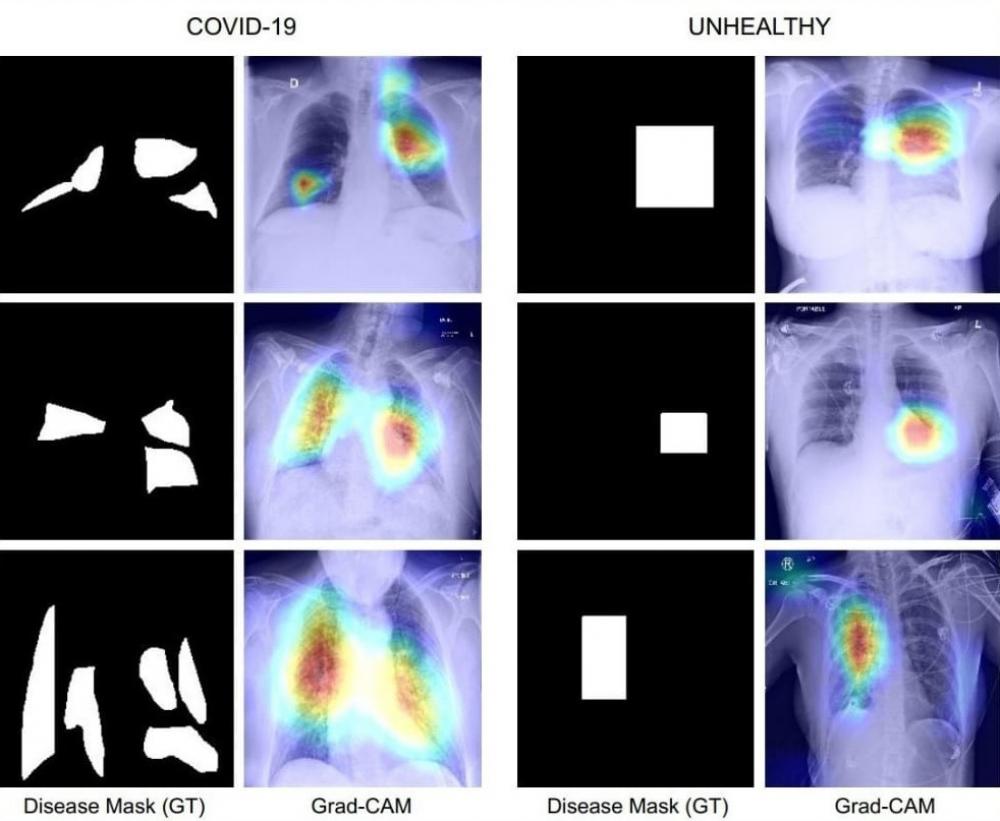 The Weekend Leader - IIT Jodhpur team develops Covid diagnosis technique using chest X-Ray